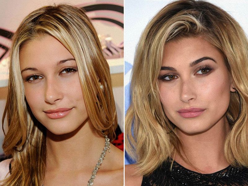 Hailey Baldwin responds to rumors about her alleged plastic surgery