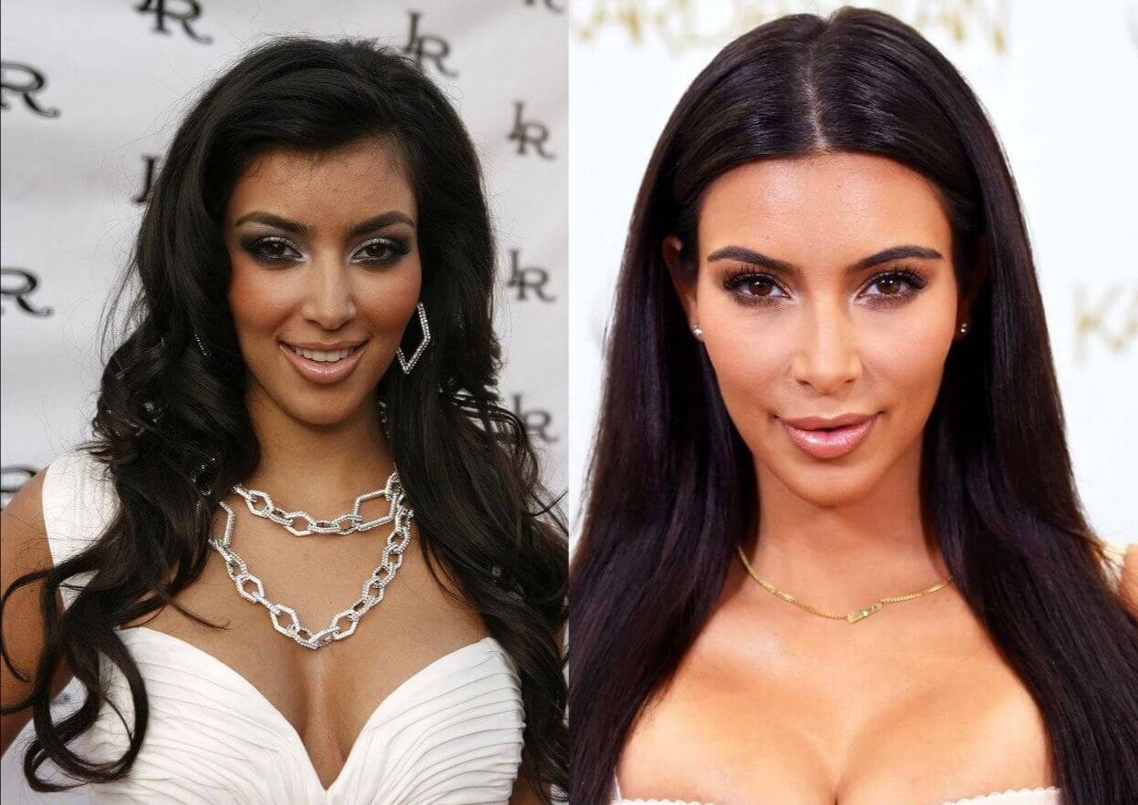 METAMORFOSIS KARDASHIAN