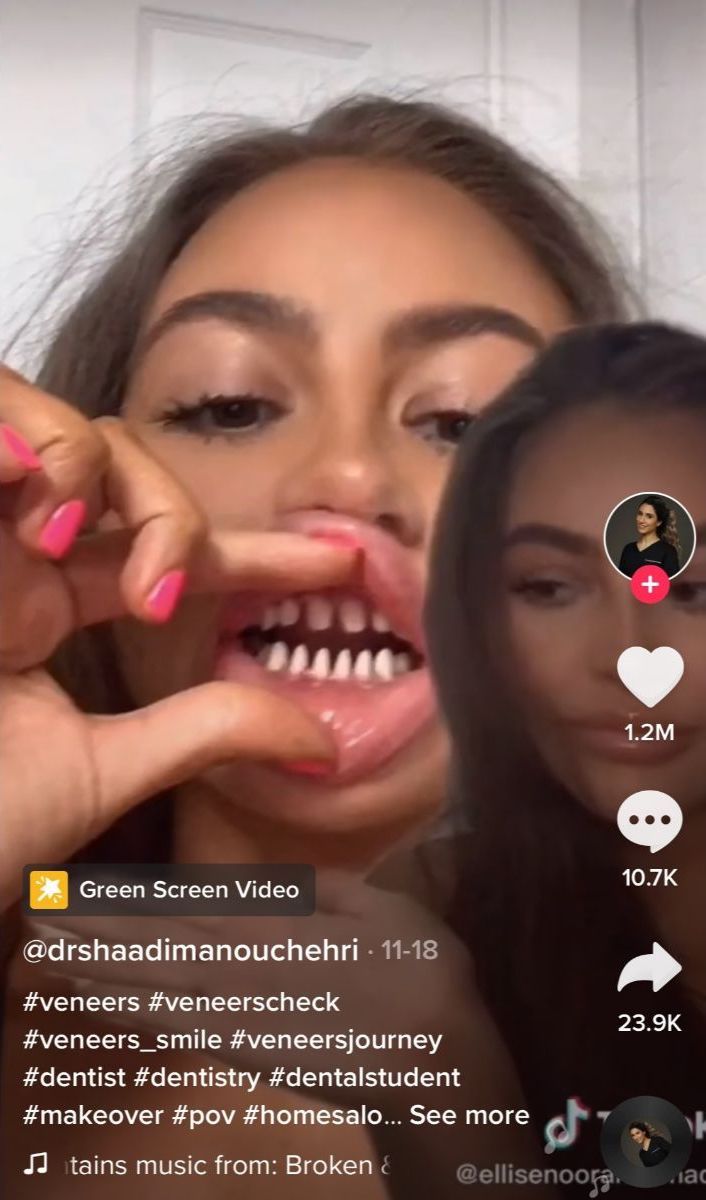 La Nueva Moda De Tiktok Que Trae Locos A Los Dentistas Highxtar