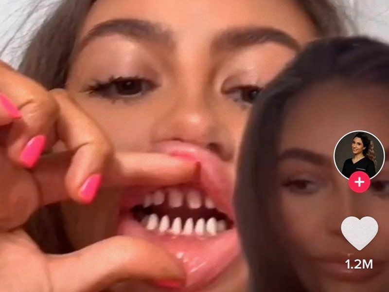 The new TikTok trend that brings dentists crazy