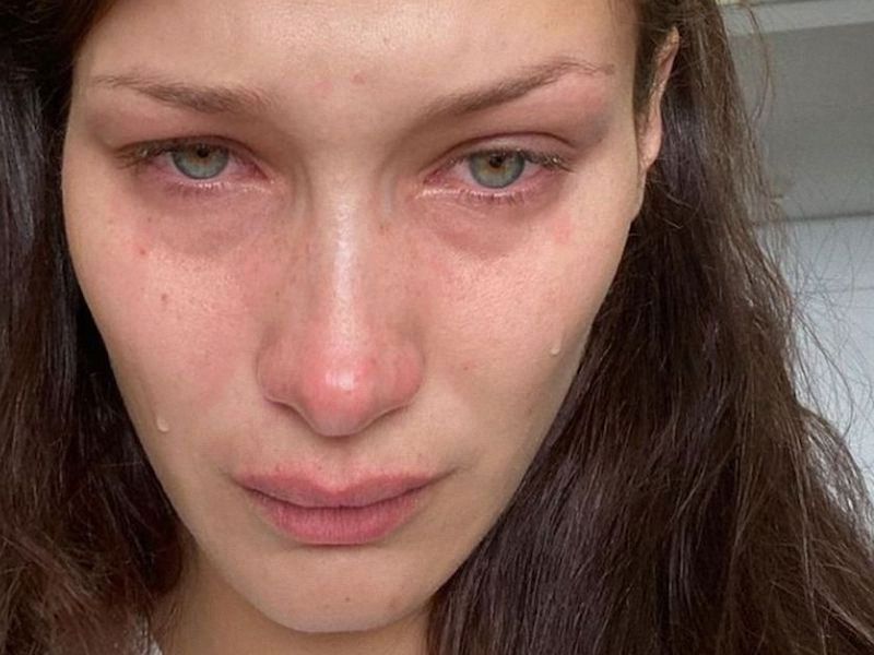 Bella Hadid talks about her mental health problems